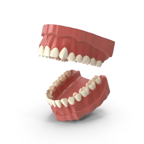 Prostheses on implants