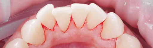 Professional oral hygiene