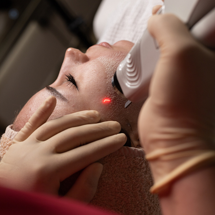 Consultation before program for resurfacing stretch marks, scars and post-acne