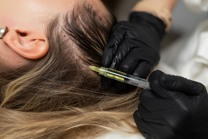 Plasmolifting procedure, PRP therapy in Moscow