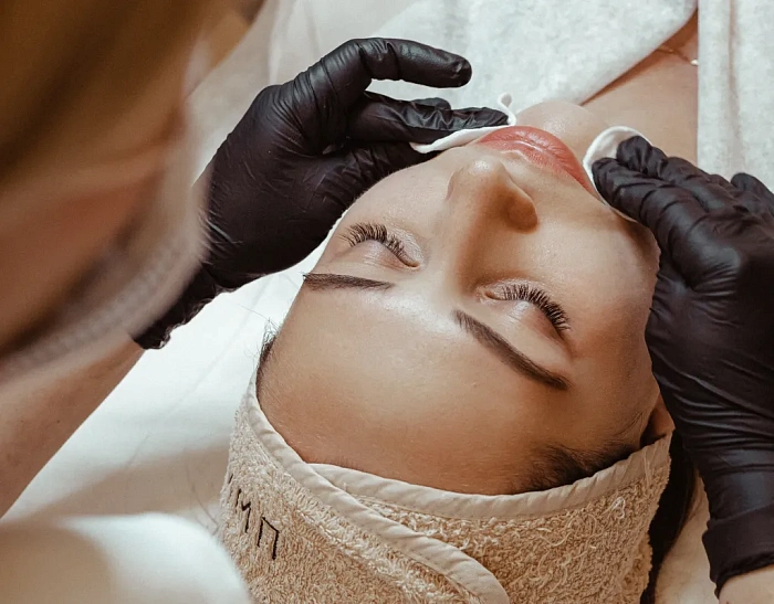 Peeling procedure
