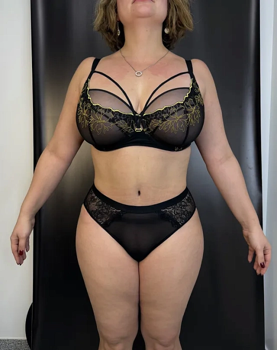 Abdominoplasty