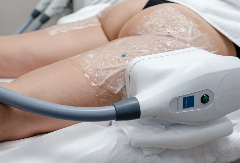 Depending on the size and location of the treated area, the doctor selects suitable applicator nozzles.