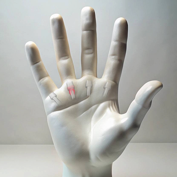 Trigger finger treatment
